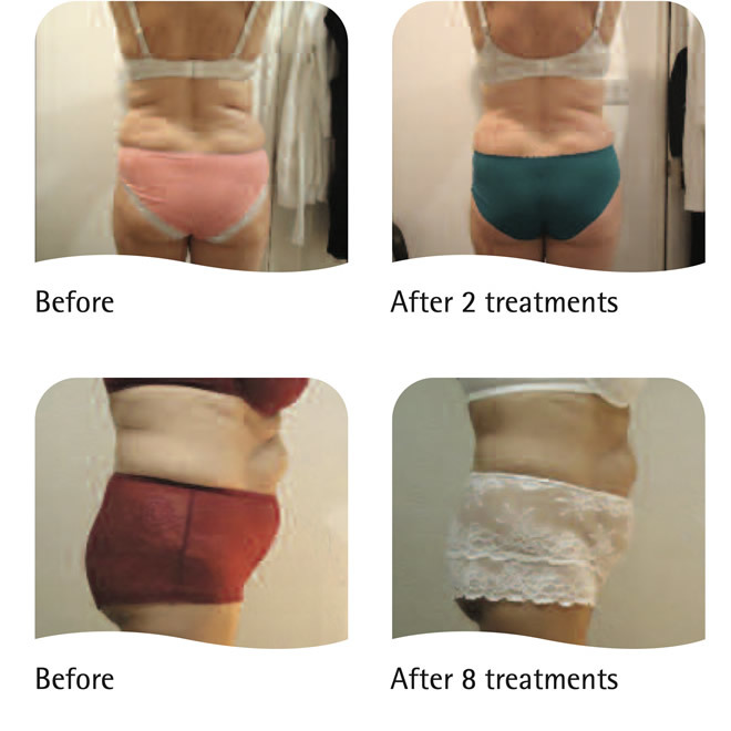 Lipogenie-results-1